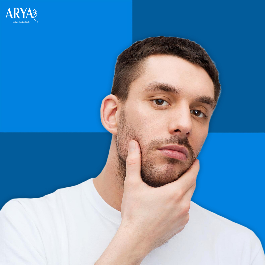 زراعة اللحية